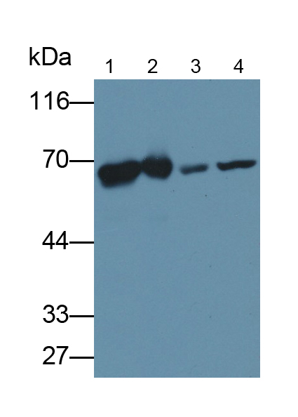 Polyclonal Antibody to Plastin 3 (PLS3)