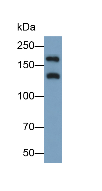 Polyclonal Antibody to PHD Finger Protein 8 (PHF8)