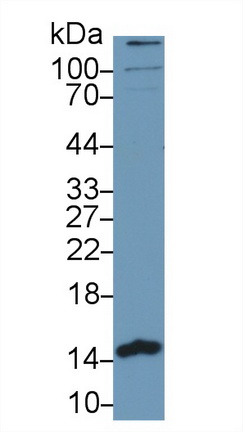 Polyclonal Antibody to Phosphohistidine Phosphatase 1 (PHPT1)