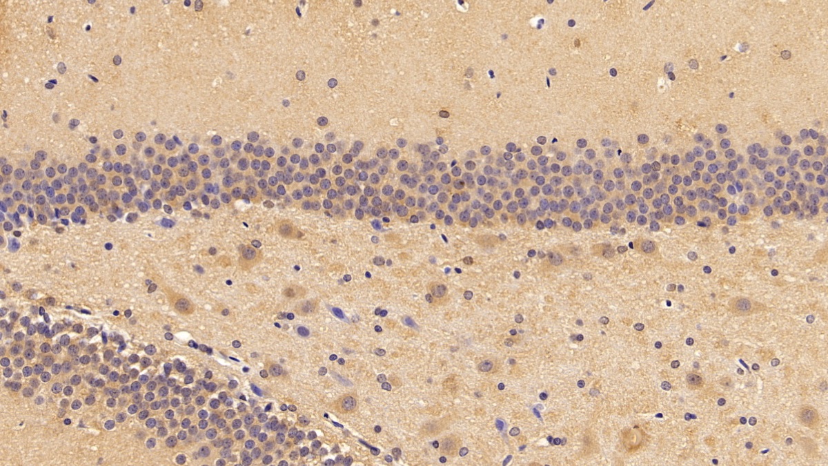 Polyclonal Antibody to Phosphohistidine Phosphatase 1 (PHPT1)