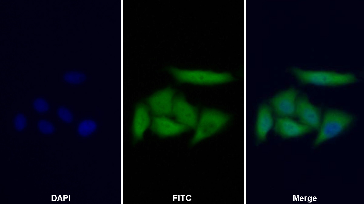 Polyclonal Antibody to Phosphohistidine Phosphatase 1 (PHPT1)