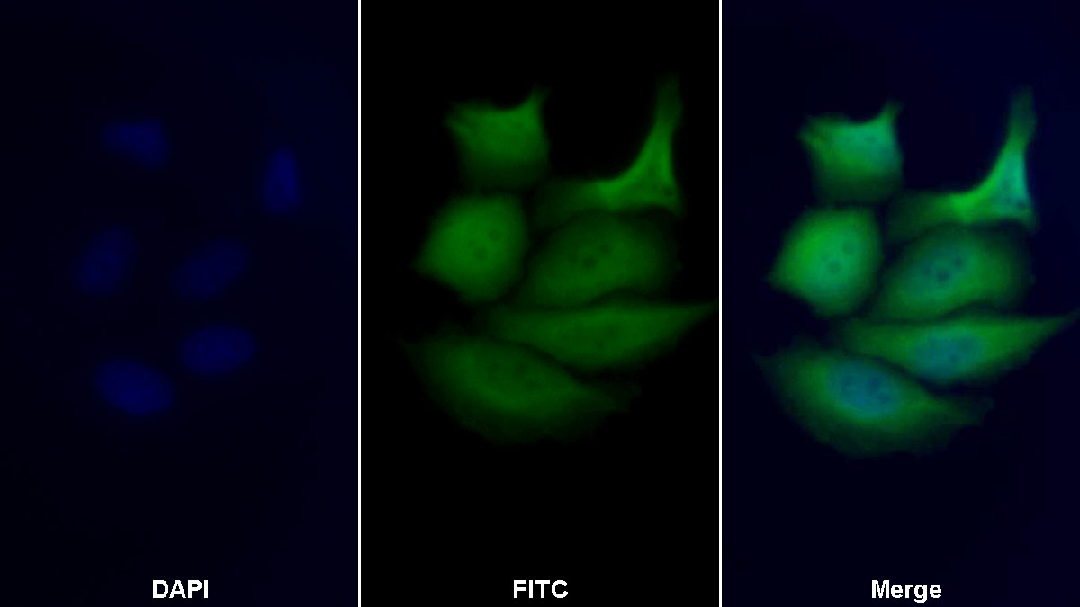 Polyclonal Antibody to Phosphohistidine Phosphatase 1 (PHPT1)