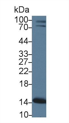 Polyclonal Antibody to Phosphohistidine Phosphatase 1 (PHPT1)