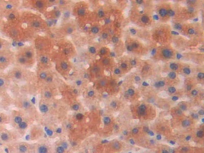 Polyclonal Antibody to Phosphoglycolate Phosphatase (PGP)