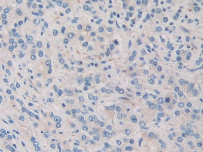 Polyclonal Antibody to Pyruvate Dehydrogenase Complex Component X (PDHX)