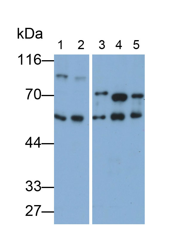 Polyclonal Antibody to Pyruvate Dehydrogenase Complex Component X (PDHX)