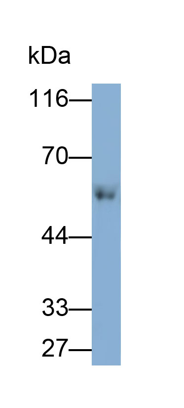 Polyclonal Antibody to Pyruvate Dehydrogenase Complex Component X (PDHX)