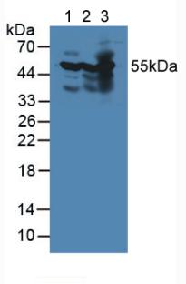 Polyclonal Antibody to Pyruvate Dehydrogenase Complex Component X (PDHX)