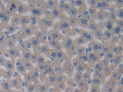 Polyclonal Antibody to Pyruvate Dehydrogenase Complex Component X (PDHX)