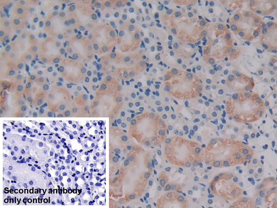 Polyclonal Antibody to Pyruvate Dehydrogenase Complex Component X (PDHX)