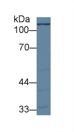 Polyclonal Antibody to Pyruvate Carboxylase (PC)