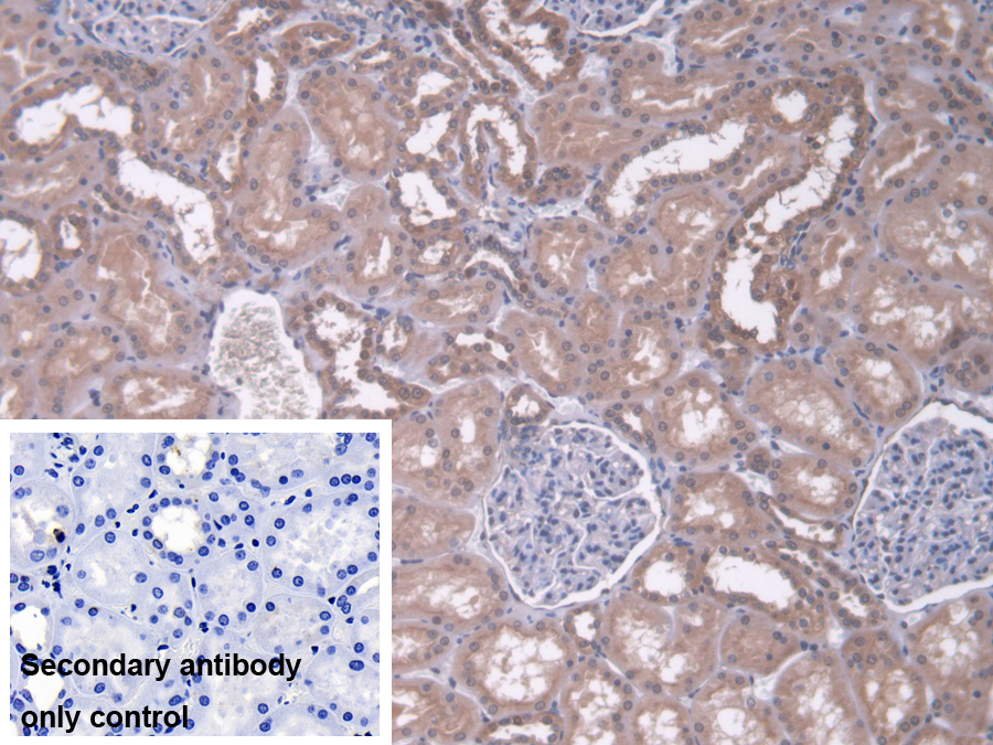 Polyclonal Antibody to Pyruvate Carboxylase (PC)