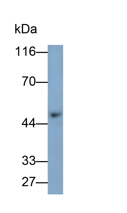 Polyclonal Antibody to Paired Box Gene 8 (PAX8)