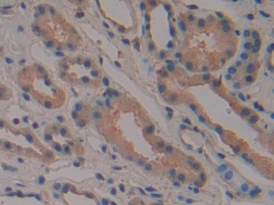 Polyclonal Antibody to p21 Protein Activated Kinase 2 (PAK2)