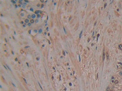 Polyclonal Antibody to p21 Protein Activated Kinase 2 (PAK2)