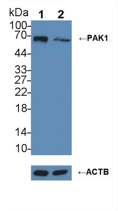 Polyclonal Antibody to p21 Protein Activated Kinase 1 (PAK1)