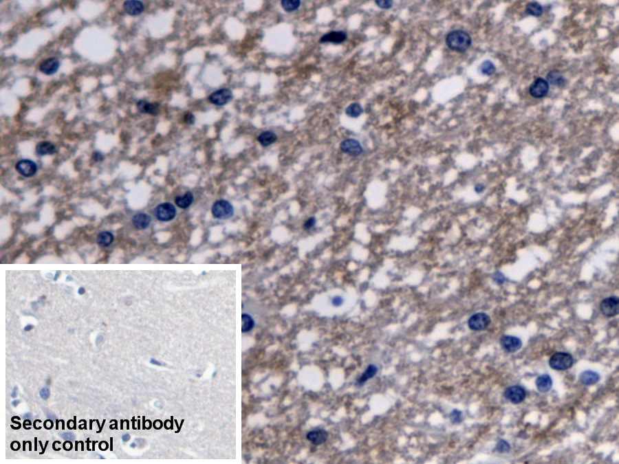 Polyclonal Antibody to 3-Oxoacid Coenzyme A Transferase 1 (OXCT1)