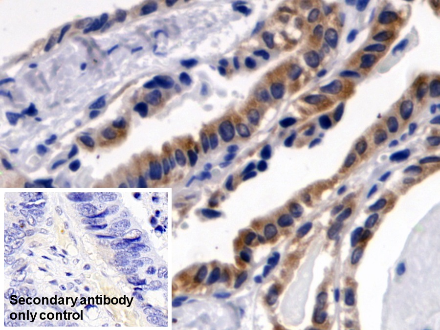 Polyclonal Antibody to 3-Oxoacid Coenzyme A Transferase 1 (OXCT1)