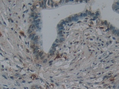 Polyclonal Antibody to Nephronectin (NPNT)