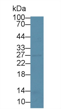 Polyclonal Antibody to Nicotinamide-N-Methyltransferase (NNMT)