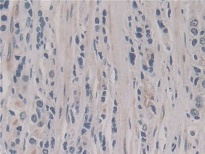 Polyclonal Antibody to Neudesin Neurotrophic Factor (NENF)