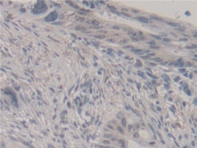 Polyclonal Antibody to Neudesin Neurotrophic Factor (NENF)