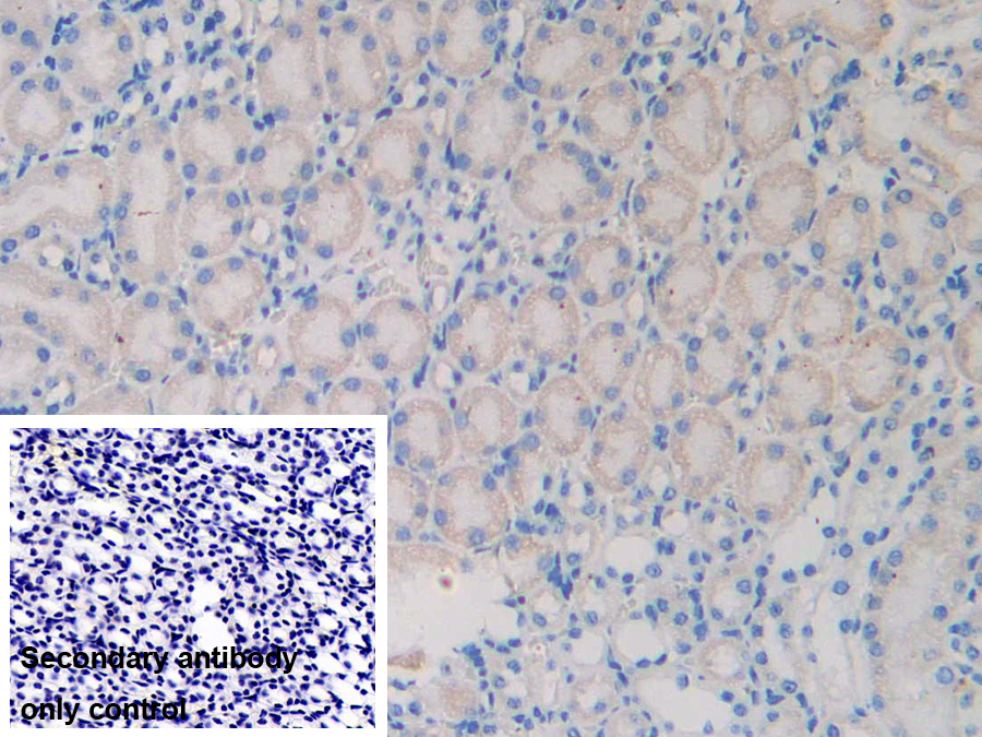 Polyclonal Antibody to Nexilin (NEXN)