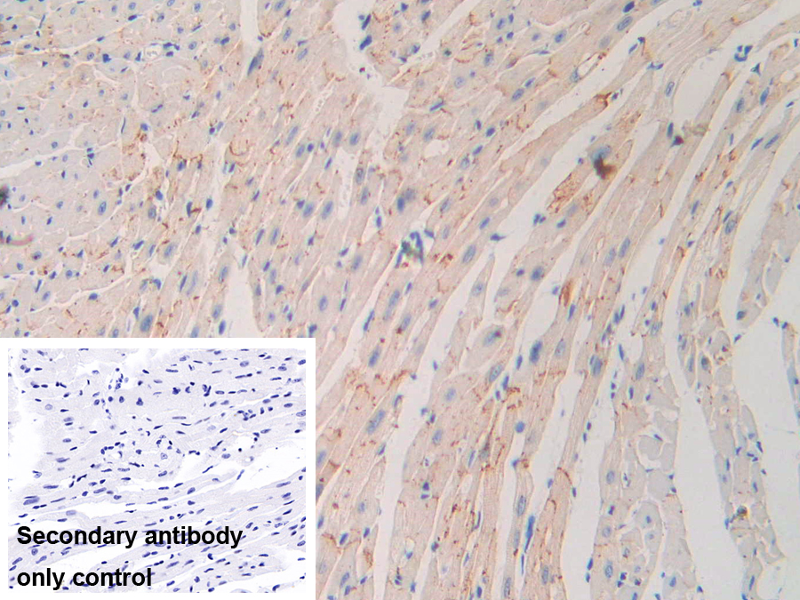 Polyclonal Antibody to Nexilin (NEXN)