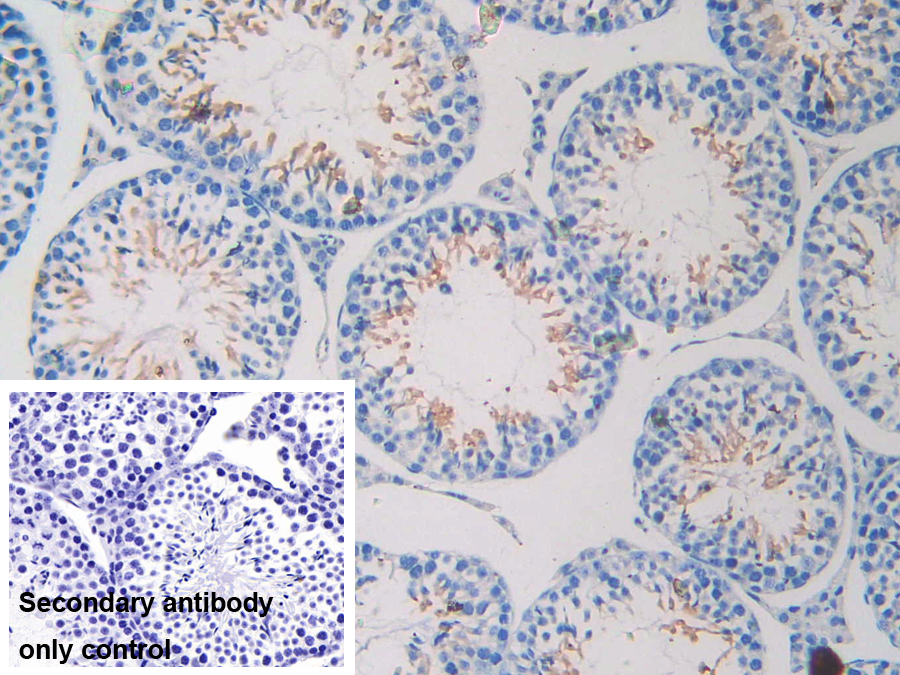 Polyclonal Antibody to Nexilin (NEXN)