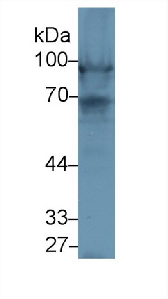 Polyclonal Antibody to Nexilin (NEXN)