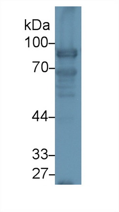 Polyclonal Antibody to Nexilin (NEXN)