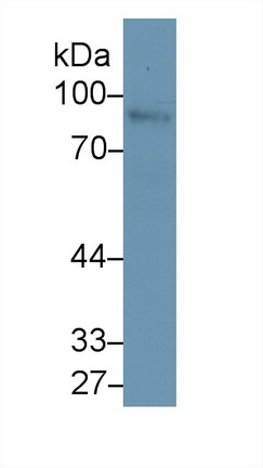 Polyclonal Antibody to Nexilin (NEXN)