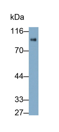 Polyclonal Antibody to Nexilin (NEXN)