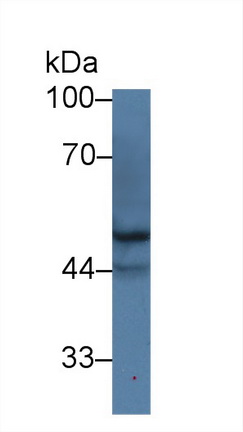 Polyclonal Antibody to Never In Mitosis Gene A Related Kinase 2 (NEK2)