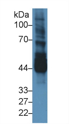 Polyclonal Antibody to Never In Mitosis Gene A Related Kinase 2 (NEK2)