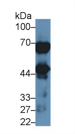 Polyclonal Antibody to N-Acetylgalactosaminidase Alpha (NAGa)