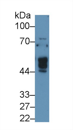 Polyclonal Antibody to N-Acetylgalactosaminidase Alpha (NAGa)