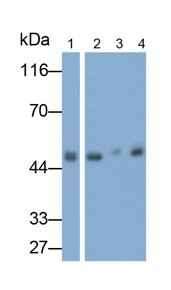 Polyclonal Antibody to N-Acetylgalactosaminidase Alpha (NAGa)