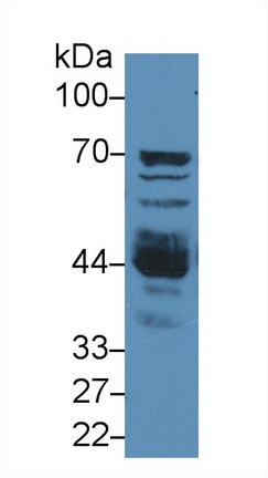 Polyclonal Antibody to N-Acetylgalactosaminidase Alpha (NAGa)