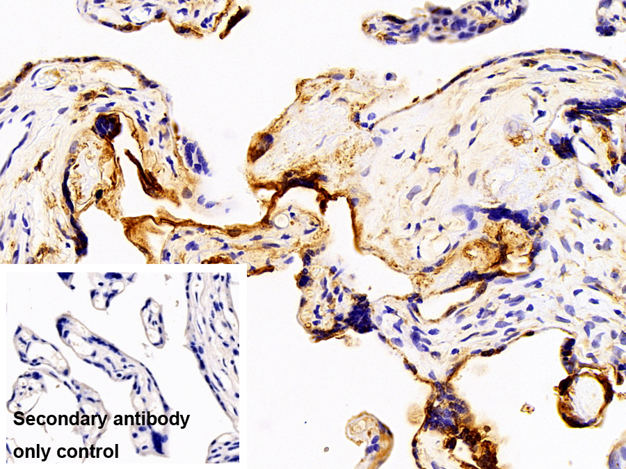 Polyclonal Antibody to N-Acetylgalactosaminidase Alpha (NAGa)