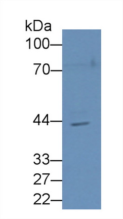 Polyclonal Antibody to N-Acetylgalactosaminidase Alpha (NAGa)