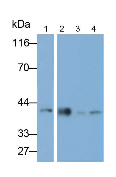 Polyclonal Antibody to N-Acetylgalactosaminidase Alpha (NAGa)