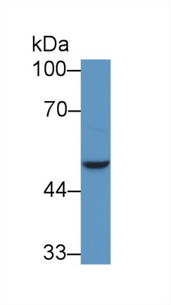 Polyclonal Antibody to NAD Kinase (NADK)