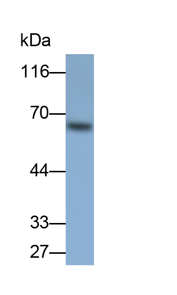 Polyclonal Antibody to NAD Kinase (NADK)