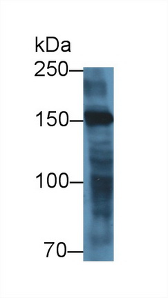 Polyclonal Antibody to Myomesin 2 (MYOM2)