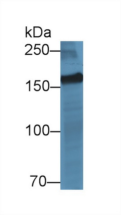 Polyclonal Antibody to Myomesin 2 (MYOM2)