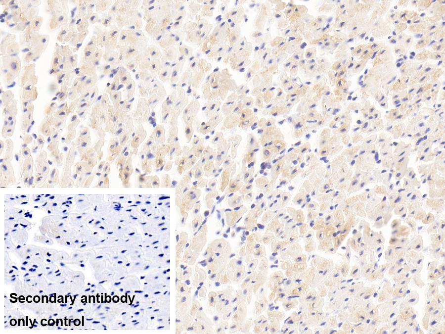 Polyclonal Antibody to Myomesin 2 (MYOM2)