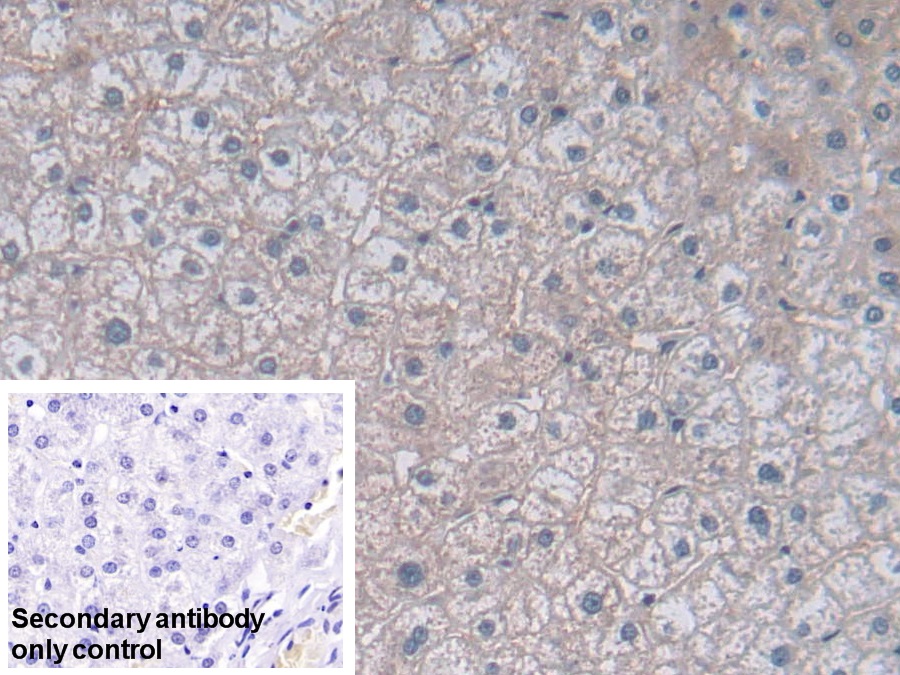 Polyclonal Antibody to Methylenetetrahydrofolate Reductase (MTHFR)