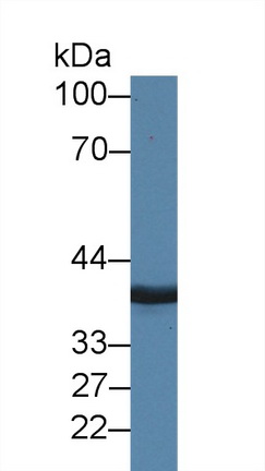 Polyclonal Antibody to Mannose Phosphate Isomerase (MPI)