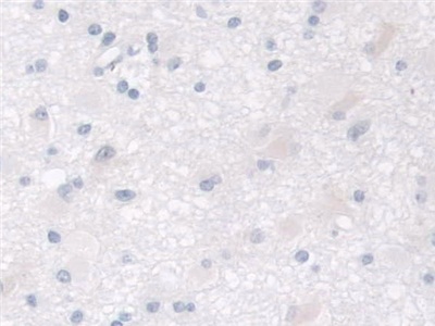 Polyclonal Antibody to Mannose Phosphate Isomerase (MPI)